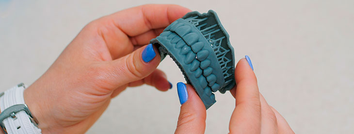 A imagem mostra duas mãos femininas, com esmalte azul nas unhas e um relógio branco no pulso esquerdo, segurando o molde em 3D de uma arcada dentária, com coloração azul celeste.